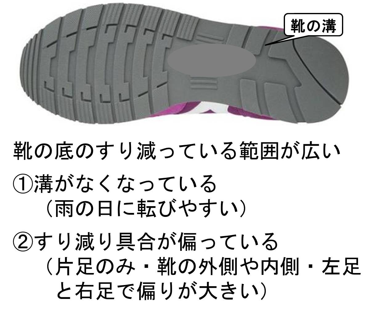 靴の交換時期　靴底のすり減りの偏り（足の故障など）、溝がなくなる（転ぶ）など